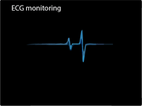 ECG monitoring