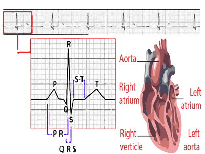 The symptoms of heart disease can vary widely depending on the type of disease from which you are suffering. Also, symptoms may sometimes be easily confused or mistaken for another cause. It has not been uncommon for people with symptoms of a heart attack to suffer more severe damage or even death because they waited too long to seek treatment. It is vital, therefore, to take note of any abnormal changes in your health and to contact your healthcare provider immediately if you feel you are suffering from symptoms of heart disease.