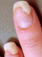 Nails - fingernail and toenail problems - Better Health ...