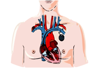 pacemaker procedure