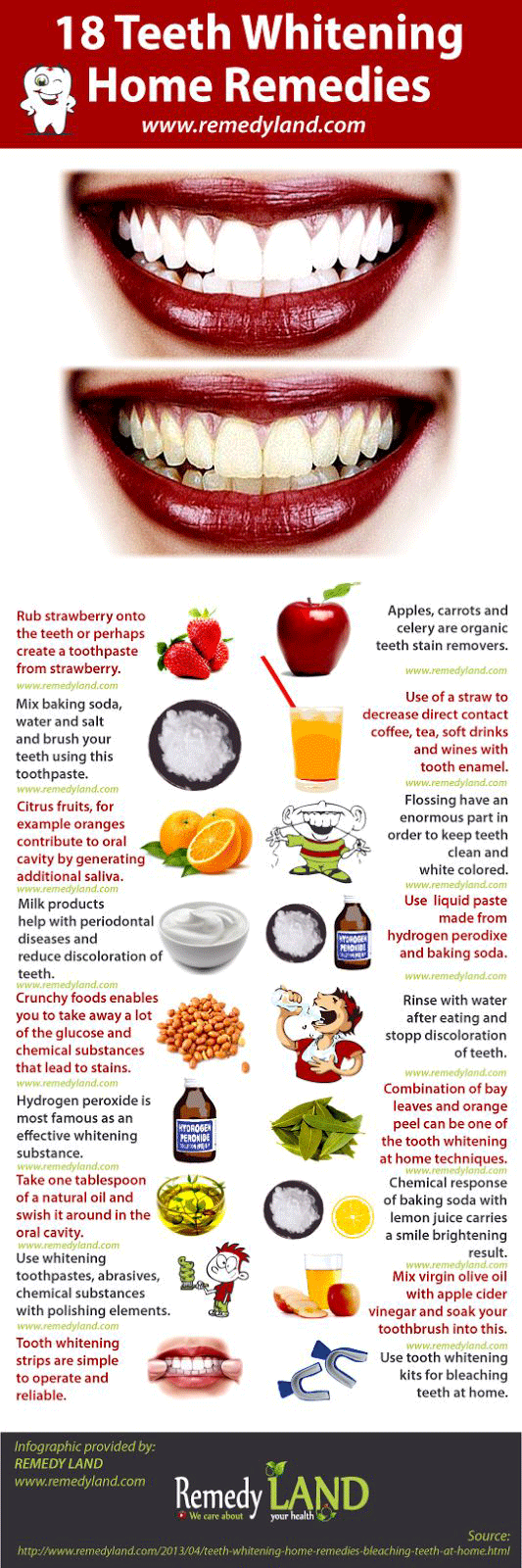 Teeth Whitening Home Remedies Infographic