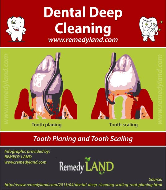 deep cleaning teeth antibiotics