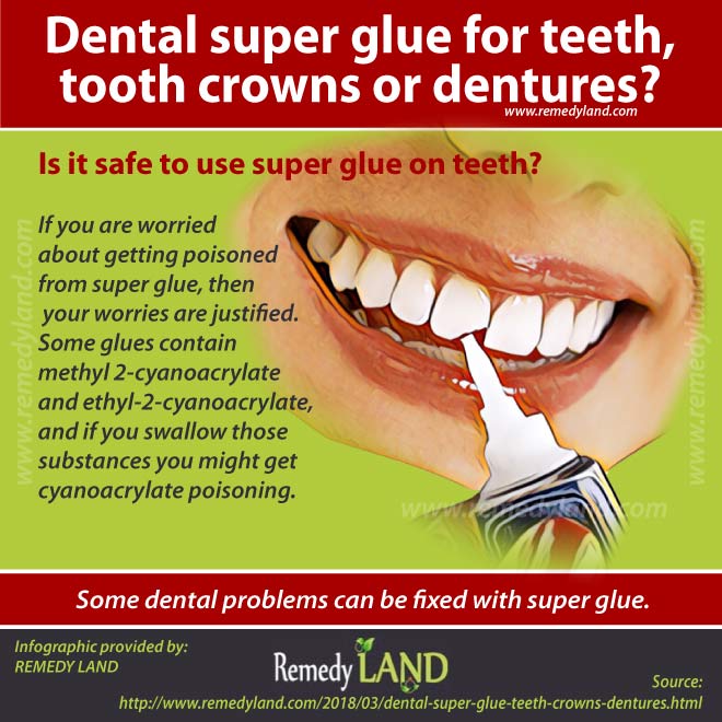 remove super glue teeth