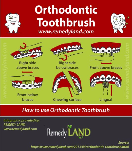 how to orthodontic toothbrush