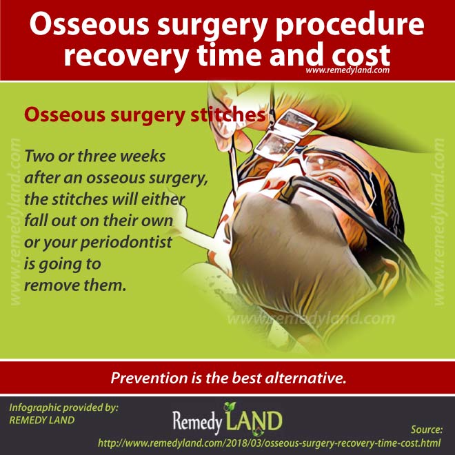 osseous surgery