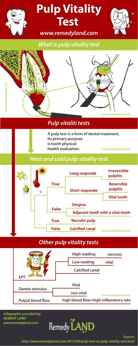 pulp vitality test