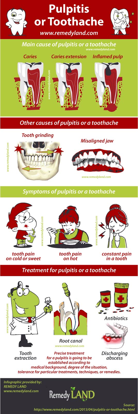 pulpitis toothache