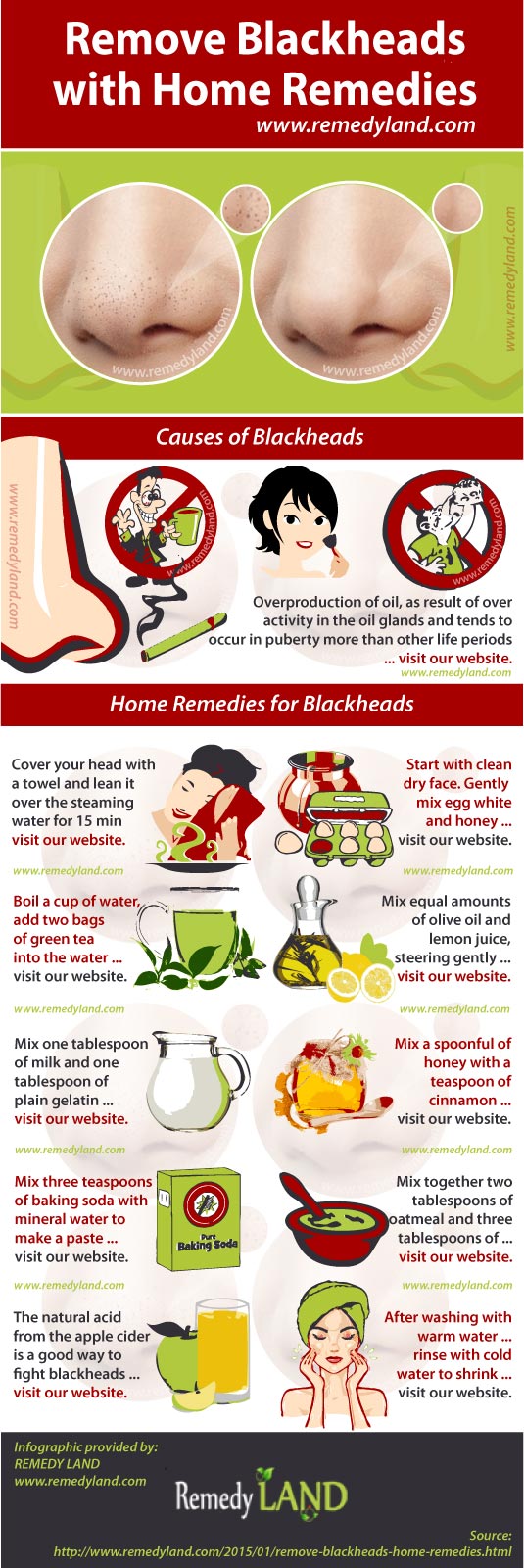 remove blackheads with home remedies