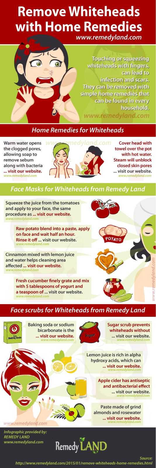 remove whiteheads with home remedies