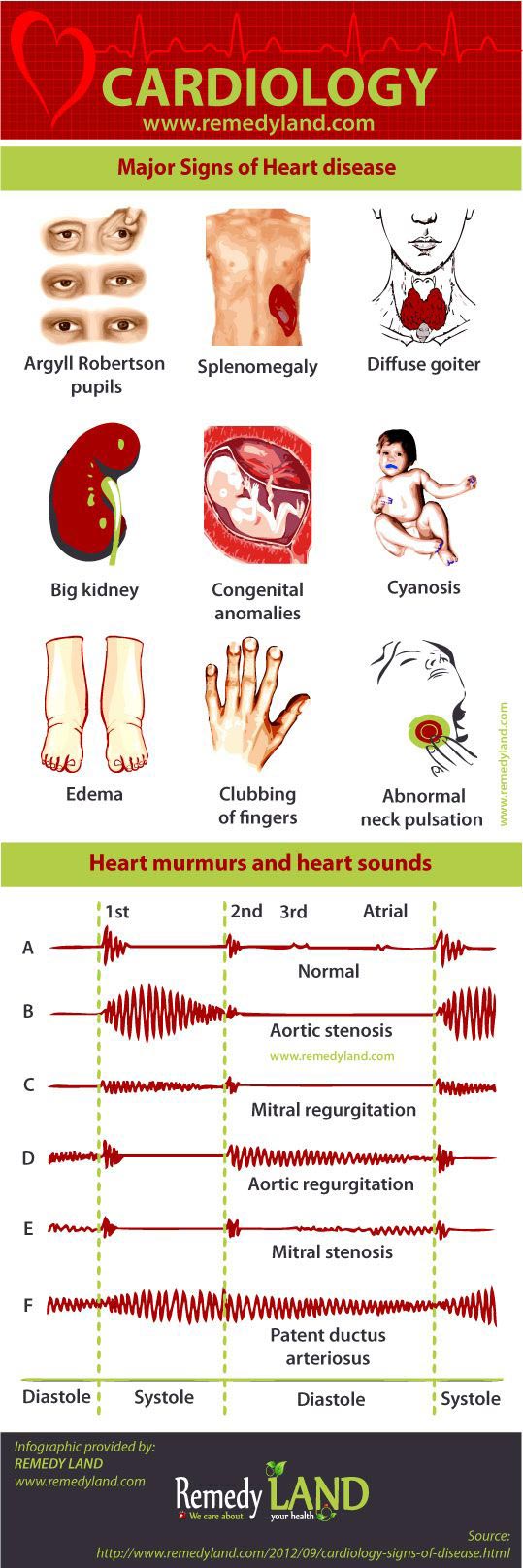 signs of heart disease infographic