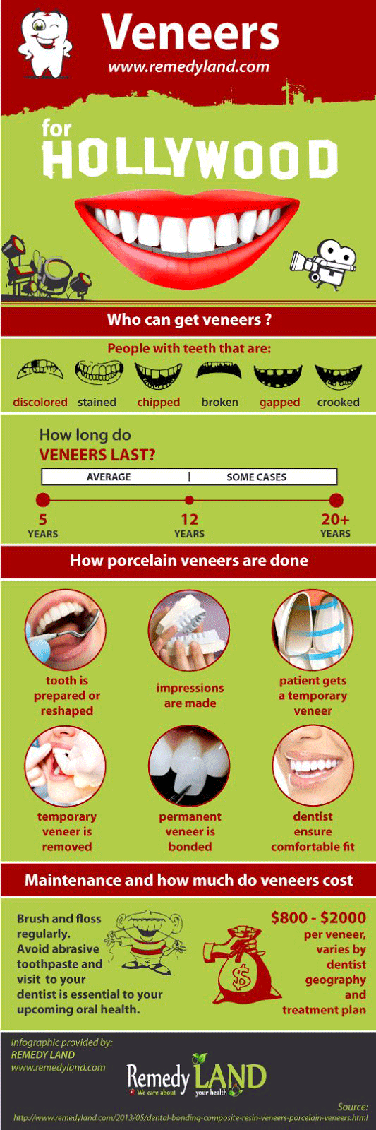 dental veneers infographic