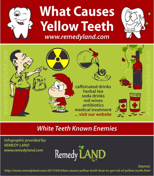 what causes yellow teeth