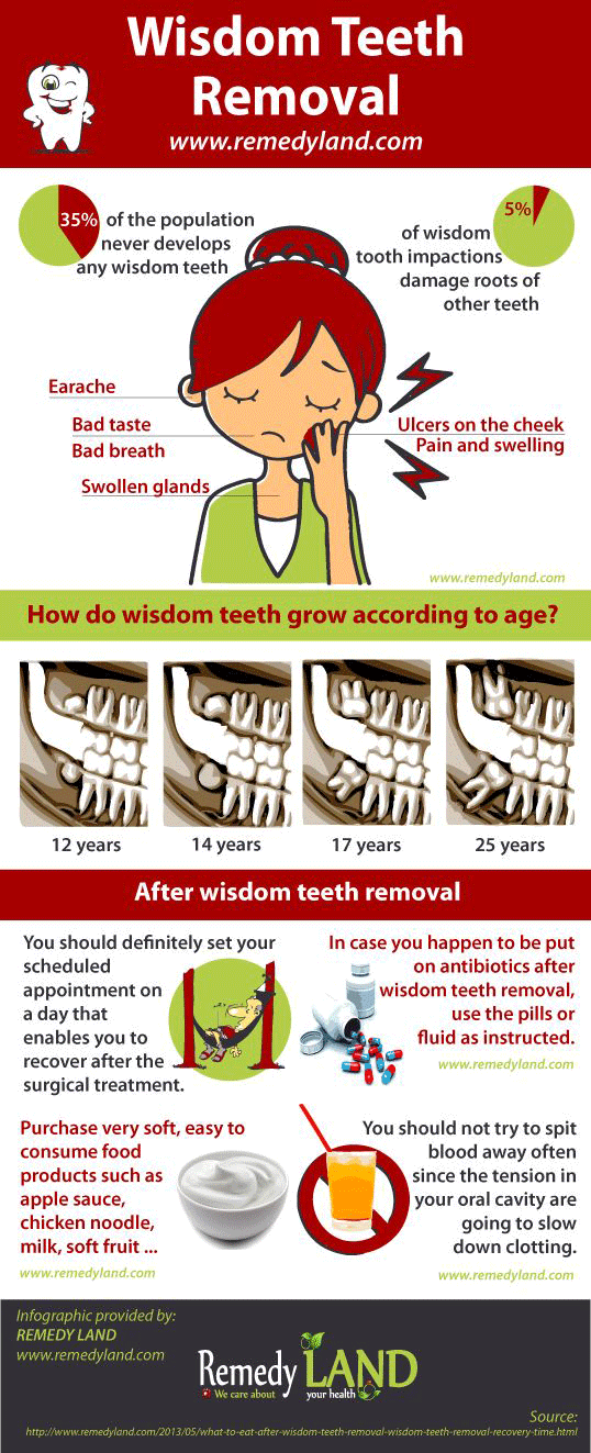 wisdom teeth removal infographic